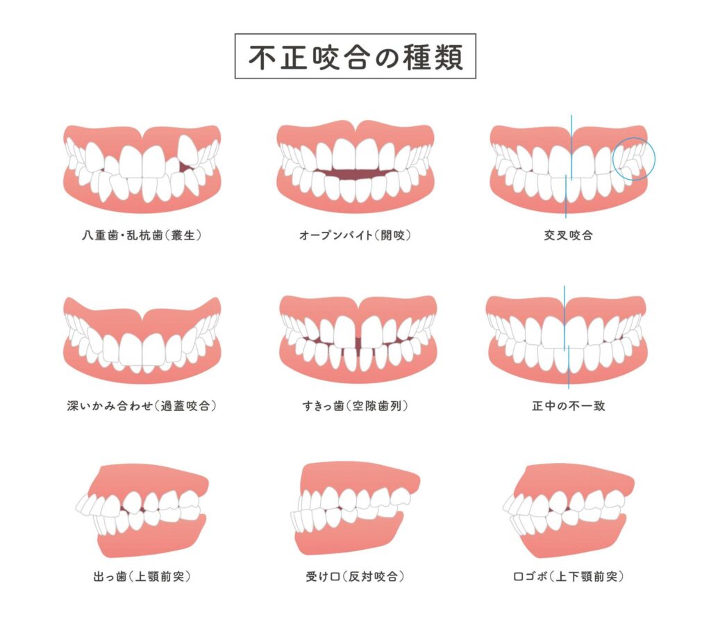 矯正歯科治療を受ける前に